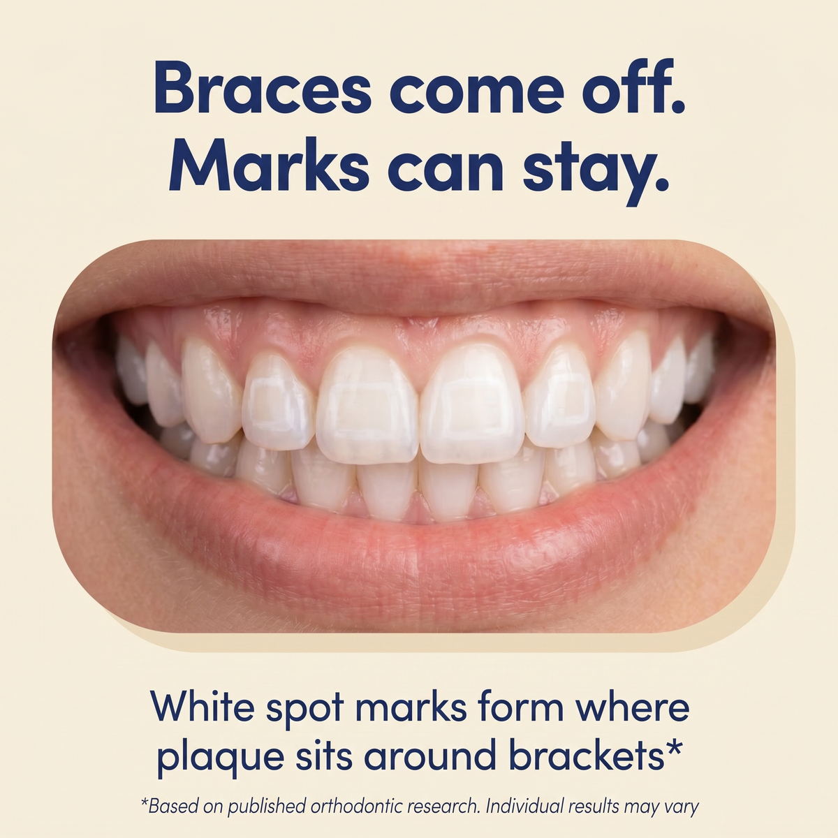 The “Braces Proof”™ Kids Water Flosser