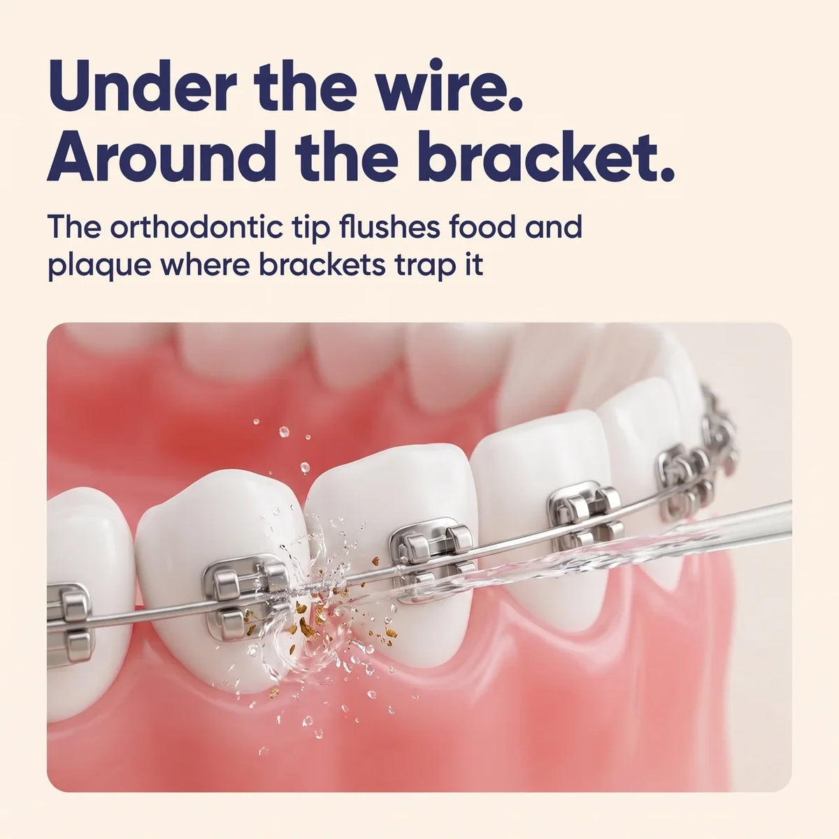The “Braces Proof”™ Kids Water Flosser
